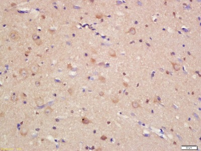 Immunohistochemistry (Formalin/PFA-fixed paraffin-embedded sections) - Anti-JAM-C antibody (AB214194)