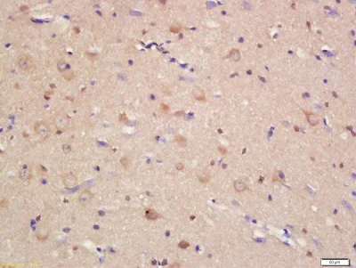 Immunohistochemistry (Formalin/PFA-fixed paraffin-embedded sections) - Anti-JAM-C antibody (AB214194)