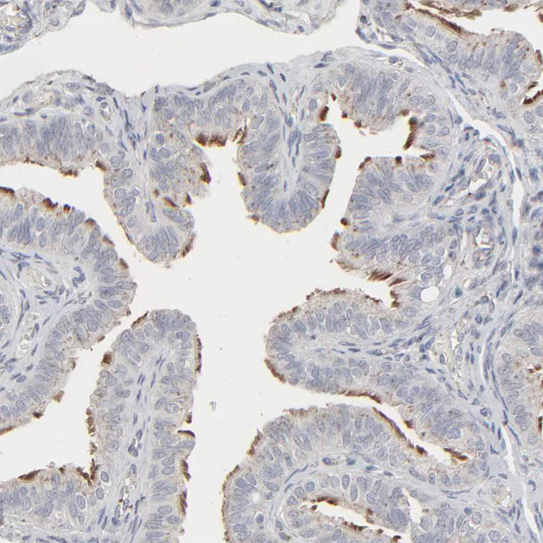 Immunohistochemistry (Formalin/PFA-fixed paraffin-embedded sections) - Anti-JAM-C antibody (AB224327)