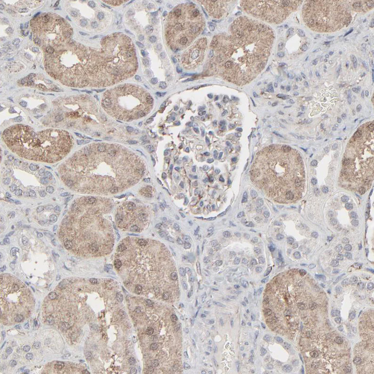 Immunohistochemistry (Formalin/PFA-fixed paraffin-embedded sections) - Anti-JAM-C antibody (AB224327)