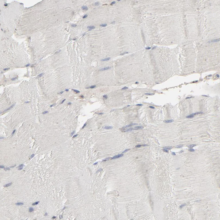 Immunohistochemistry (Formalin/PFA-fixed paraffin-embedded sections) - Anti-JAM-C antibody (AB224327)