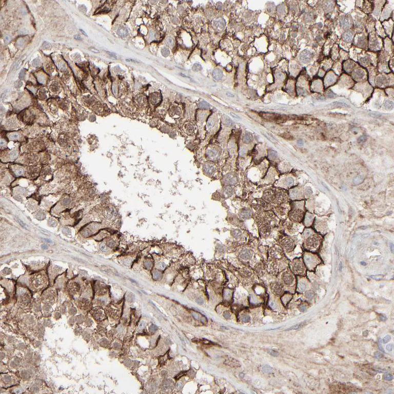 Immunohistochemistry (Formalin/PFA-fixed paraffin-embedded sections) - Anti-JAM-C antibody (AB224327)