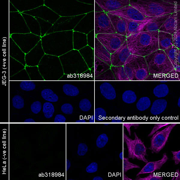 Immunocytochemistry/ Immunofluorescence - Anti-JAM-C antibody [EPR29224-576] - BSA and Azide free (AB318985)