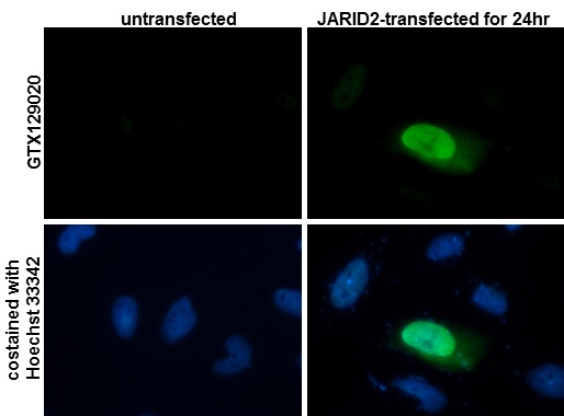 Immunocytochemistry/ Immunofluorescence - Anti-Jarid2 antibody (AB184152)