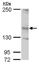 Western blot - Anti-Jarid2 antibody (AB184152)