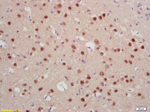 Immunohistochemistry (Formalin/PFA-fixed paraffin-embedded sections) - Anti-Jarid2 antibody (AB213679)