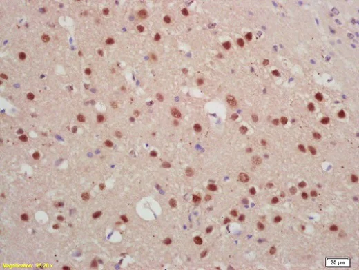 Immunohistochemistry (Formalin/PFA-fixed paraffin-embedded sections) - Anti-Jarid2 antibody (AB213679)