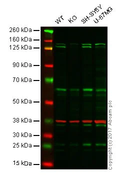 Western blot - Anti-Jarid2 antibody [EPR6357(2)] - BSA and Azide free (AB251123)