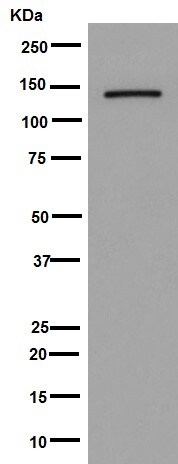 Western blot - Anti-Jarid2 antibody [EPR6357(2)] - BSA and Azide free (AB251123), expandable thumbnail