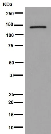 Western blot - Anti-Jarid2 antibody [EPR6357(2)] - BSA and Azide free (AB251123)