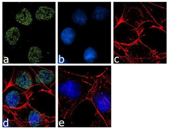 Immunocytochemistry/ Immunofluorescence - Anti-Jarid2 antibody [RP23040193] (AB308119)
