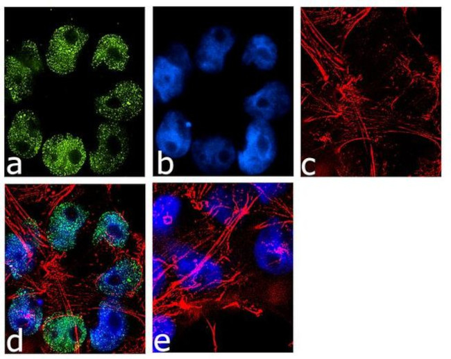 Immunocytochemistry/ Immunofluorescence - Anti-Jarid2 antibody [RP23040193] (AB308119)