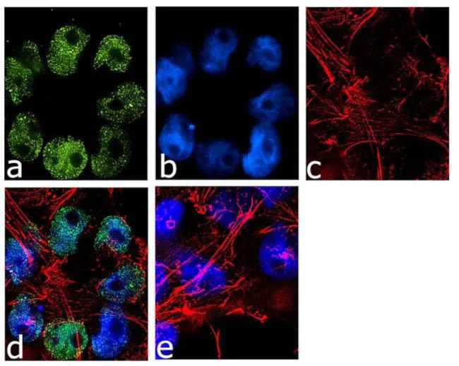 Immunocytochemistry/ Immunofluorescence - Anti-Jarid2 antibody [RP23040193] (AB308119)