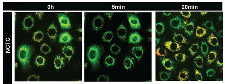 JC-1 - Mitochondrial Membrane Potential Assay Kit (ab113850