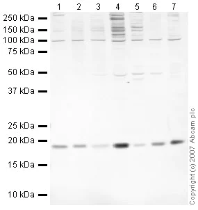 Western blot - Anti-JDP2 antibody (AB40916)