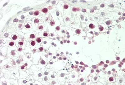 Immunohistochemistry (Formalin/PFA-fixed paraffin-embedded sections) - Anti-JHDM1D antibody (AB230894)