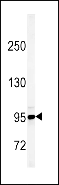 Western blot - Anti-JHDM1D antibody (AB230894)