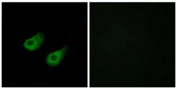Immunocytochemistry/ Immunofluorescence - Anti-JIP3 antibody (AB196761)