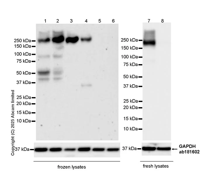 Western blot - Anti-JIP3 antibody [EPR30425-79] (AB326560)