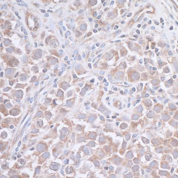 Immunohistochemistry (Formalin/PFA-fixed paraffin-embedded sections) - Anti-JLP antibody (AB12331)