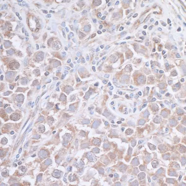 Immunohistochemistry (Formalin/PFA-fixed paraffin-embedded sections) - Anti-JLP antibody (AB12331)