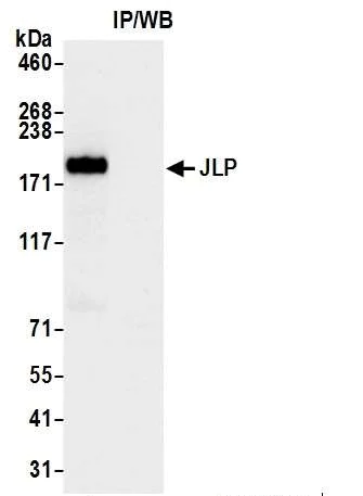 Immunoprecipitation - Anti-JLP antibody (AB12331)