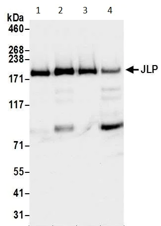 Western blot - Anti-JLP antibody (AB12331)