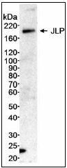 Western blot - Anti-JLP antibody (AB12332), expandable thumbnail