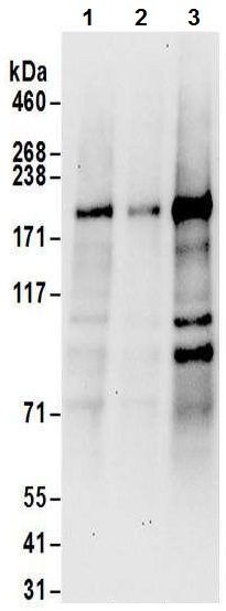 Western blot - Anti-JLP antibody (AB12332), expandable thumbnail