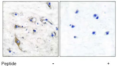 Immunohistochemistry (Formalin/PFA-fixed paraffin-embedded sections) - Anti-JM4/PRAF2 antibody (AB53113)