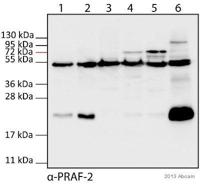 Western blot - Anti-JM4/PRAF2 antibody (AB53113), expandable thumbnail