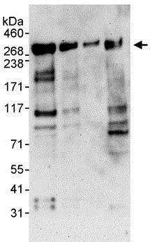 Western blot - Anti-JMJD1C antibody (AB130922)