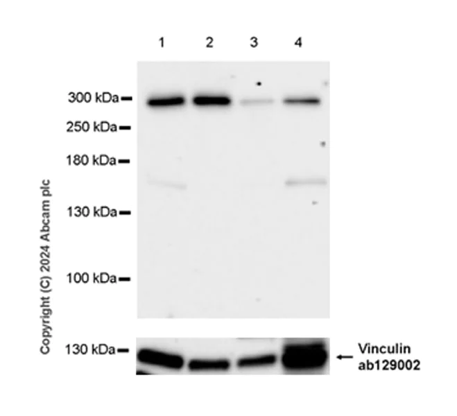 Western blot - Anti-JMJD1C antibody [EPR27248-29] (AB316320)