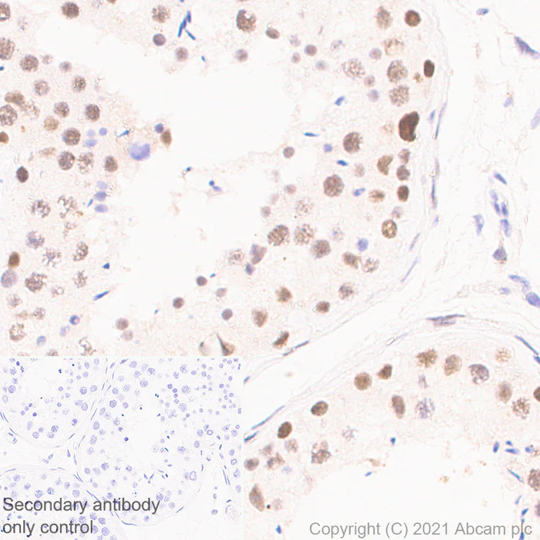 Immunohistochemistry (Formalin/PFA-fixed paraffin-embedded sections) - Anti-JMJD6 antibody [EPR23672-71] (AB256798)