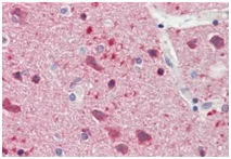 Immunohistochemistry (Formalin/PFA-fixed paraffin-embedded sections) - Anti-JMY antibody - C-terminal (AB190212)