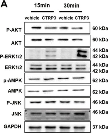 Western blot - Anti-JNK1 antibody [EPR17557] (AB199380)