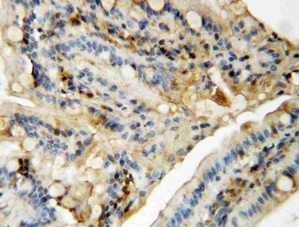 Immunohistochemistry (Formalin/PFA-fixed paraffin-embedded sections) - Anti-JNK1 + JNK2 antibody (AB112501), expandable thumbnail