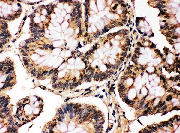 Immunohistochemistry (Formalin/PFA-fixed paraffin-embedded sections) - Anti-JNK1 + JNK2 antibody (AB112501), expandable thumbnail