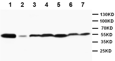 Western blot - Anti-JNK1 + JNK2 antibody (AB112501), expandable thumbnail