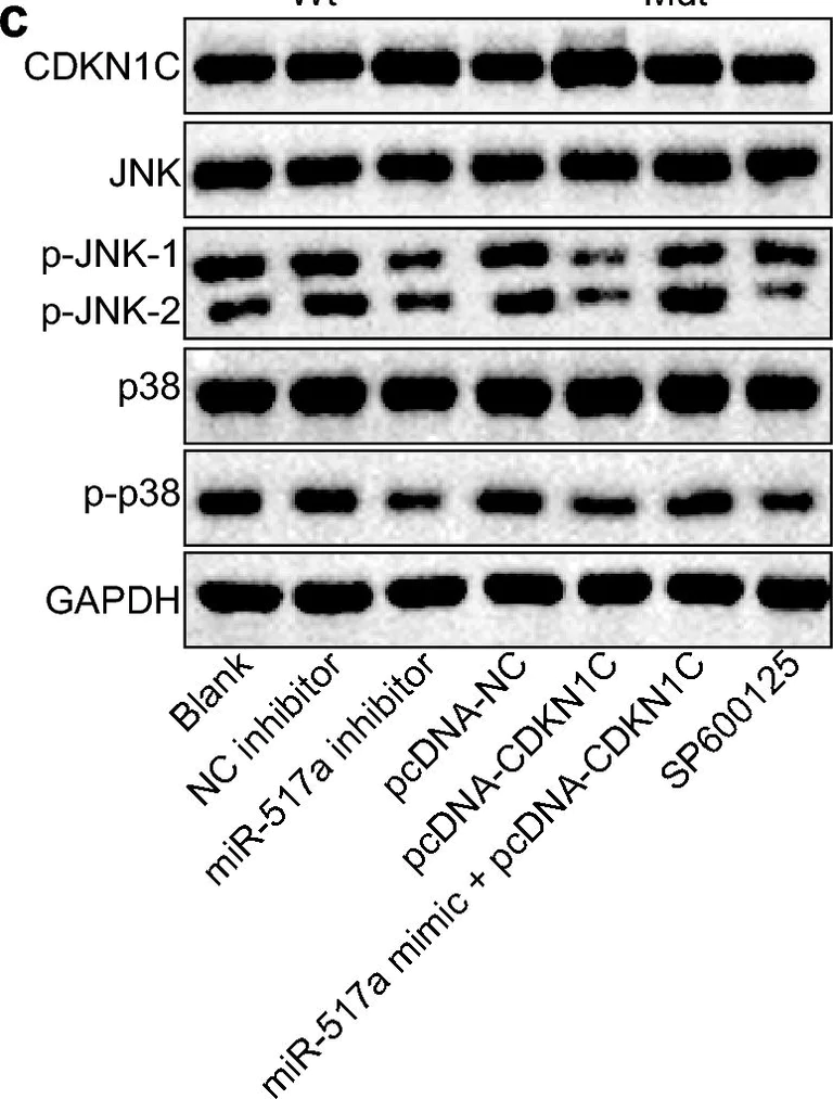 Western blot - Anti-JNK1 + JNK2 antibody (AB112501)
