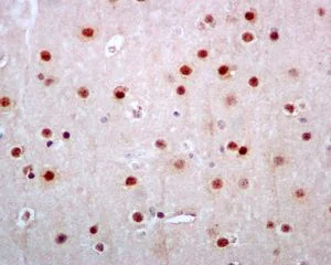 Immunohistochemistry (Formalin/PFA-fixed paraffin-embedded sections) - Anti-JNK1 + JNK2 + JNK3 (phospho T183+T183+T221) antibody [EPR5693] (AB124956)