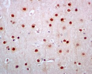 Immunohistochemistry (Formalin/PFA-fixed paraffin-embedded sections) - Anti-JNK1 + JNK2 + JNK3 (phospho T183+T183+T221) antibody [EPR5693] - BSA and Azide free (AB219584), expandable thumbnail