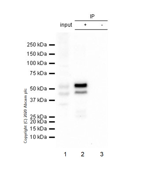 Immunoprecipitation - Anti-JNK1 + JNK2 + JNK3 (phospho T183+T183+T221) antibody [EPR5693] - BSA and Azide free (AB219584), expandable thumbnail