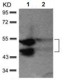 Western blot - Anti-JNK1 + JNK2 (phospho T183 + Y185) antibody (AB131499)