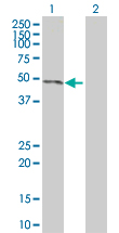 Western blot - JNK1 overexpression 293T lysate (whole cell) (AB94122)