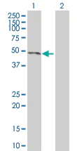 Western blot - JNK1 overexpression 293T lysate (whole cell) (AB94122)
