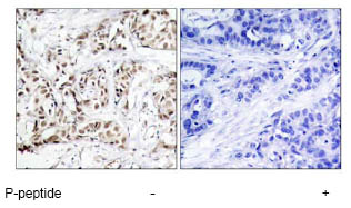 Immunohistochemistry (Formalin/PFA-fixed paraffin-embedded sections) - Anti-JNK1 (phospho T183) antibody (AB47337)