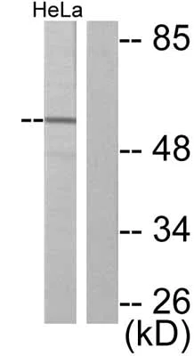 Western blot - Anti-JNK1 (phospho T183) antibody (AB47337)
