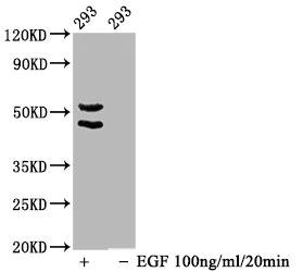 Western blot - Anti-JNK1 (phospho T183) + JNK2 (phospho T183) + JNK3 (phospho T221) antibody [1A9] (AB314039)