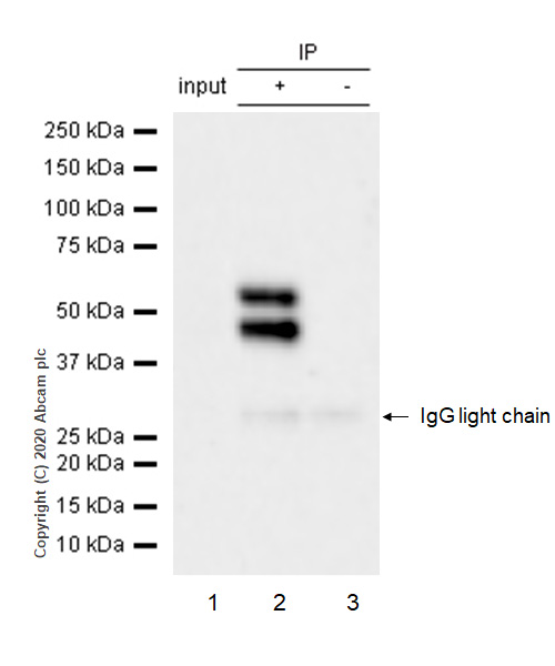 Immunoprecipitation - Anti-JNK1 (phospho Y185) + JNK2 (phospho Y185) + JNK3 (phospho Y223) antibody [EP1597Y] (AB76572), expandable thumbnail